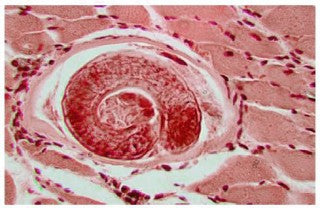 PESKY PARASITES